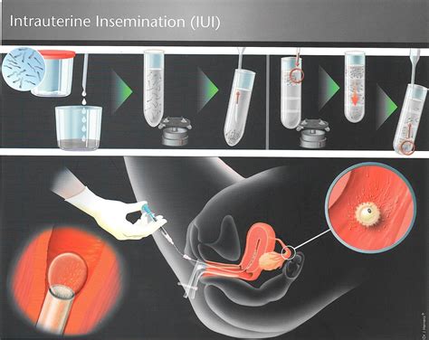 insemination porn|Insemination Porn Videos 